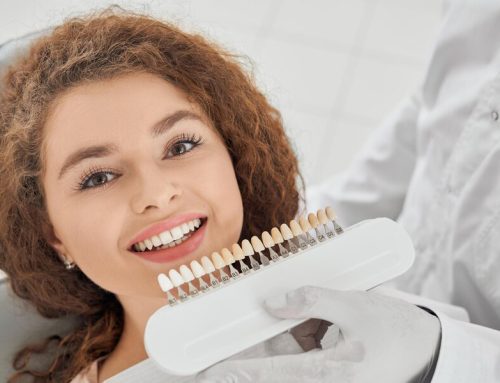 ما الذي يمكن أن يبيض الأسنان الصفراء؟ 12 سببًا لاصفرار الأسنان وعلاجها