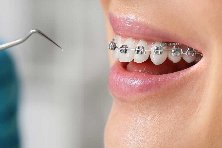 دندانپزشکی اصفهان