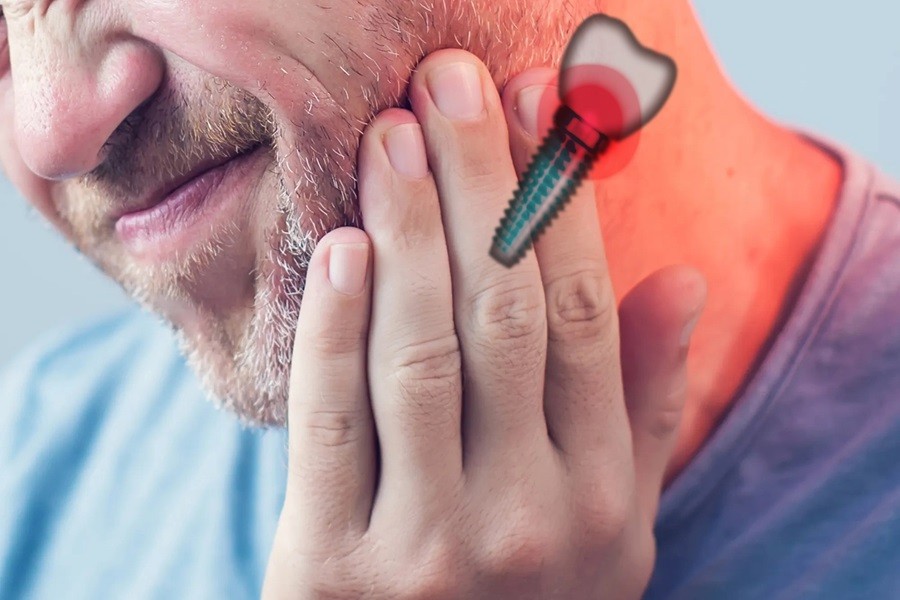 گوش درد بعد از ایمپلنت